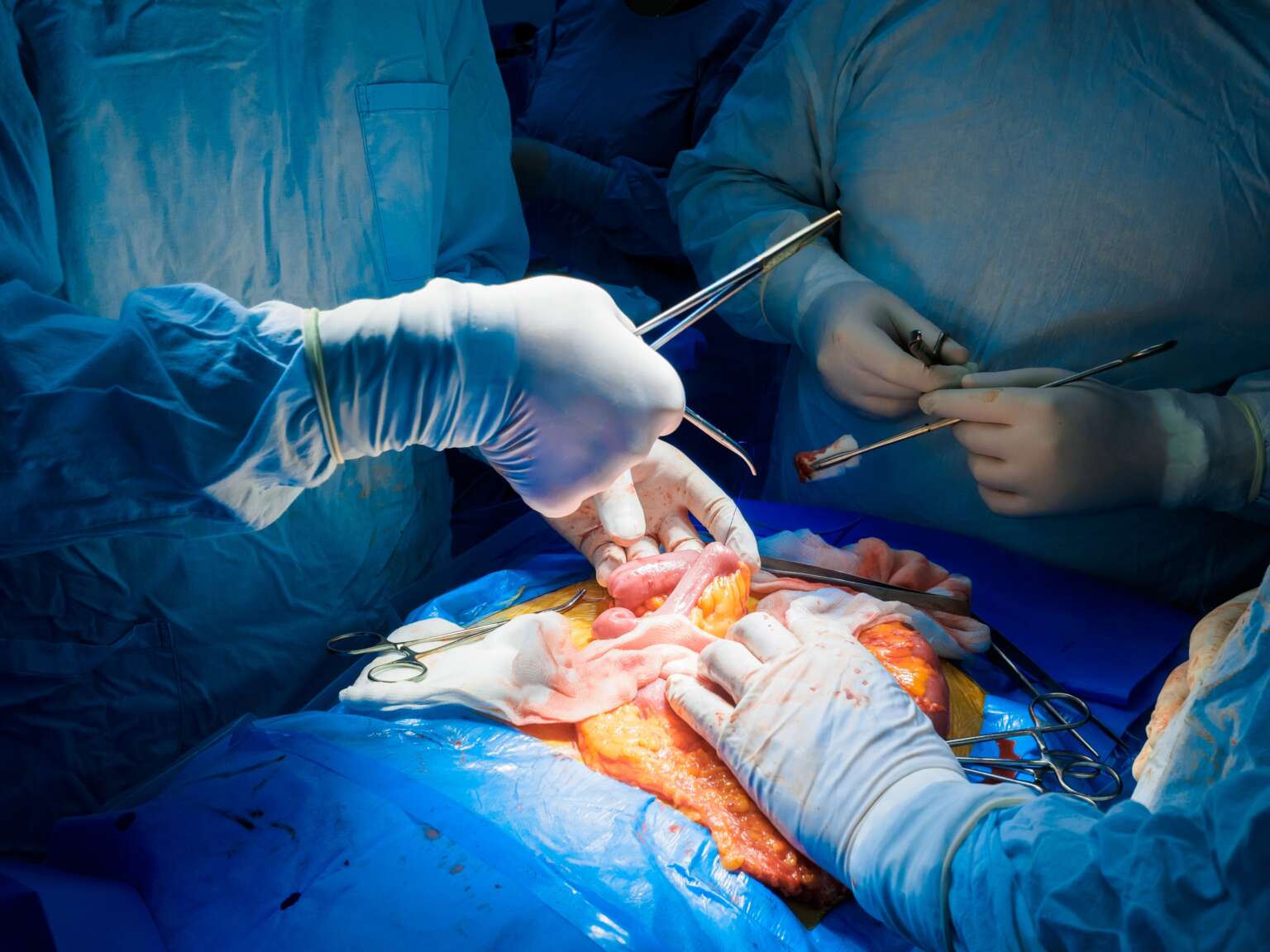 Surgeons in the OR